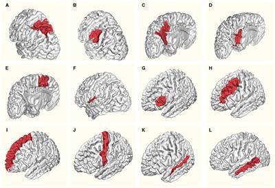 Rényi entropy-complexity causality space: a novel neurocomputational tool for detecting scale-free features in EEG/iEEG data